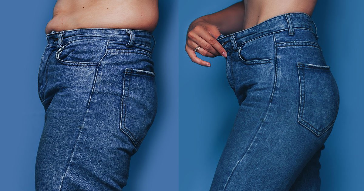 Mistakes - Why You’re Not Losing Weight On Phentermine? | Dr2bThin